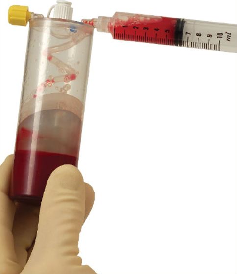 PRP 03